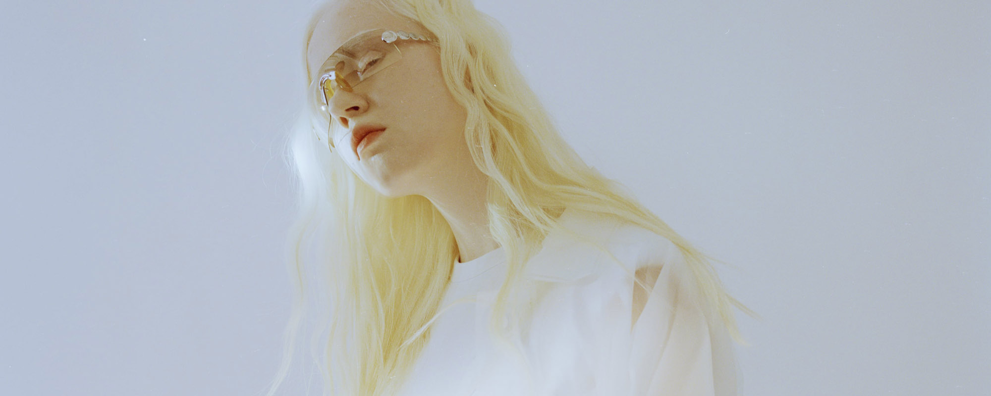 Девушка-альбинос Анастасия Пяткова: ‎«Я такой родилась и не знаю, как быть другой»‎